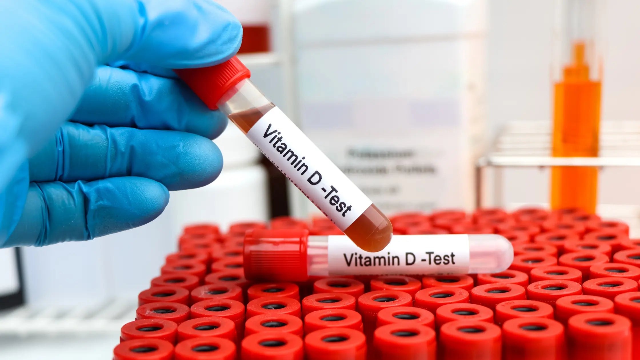 Vitamine D tekort